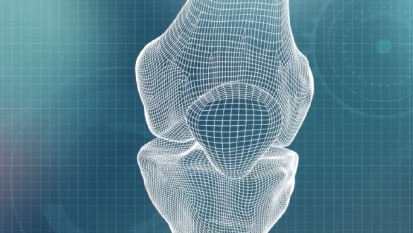 3D knee image